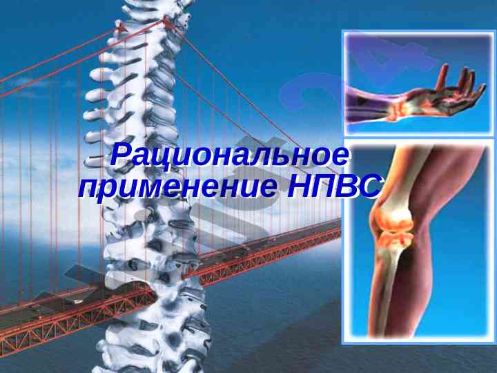 Рациональное применение нпвс в клинической фармации