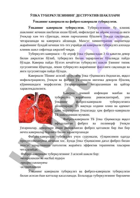 Upka tuberkuliezining destruktiv shakllari va tahlili