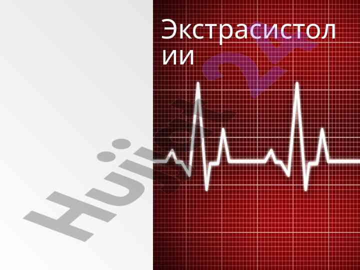Ekstrasistoliya tahlili va klassifikatsiyasi