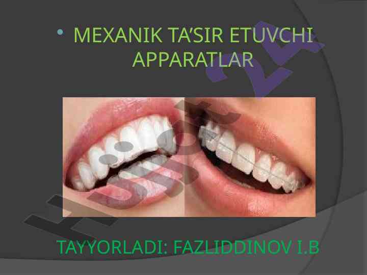 Mexanik ta’sir etuvchi apparatlar tushunchasi