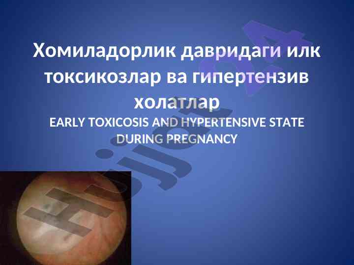 Хомиладорлик даврида токсикоз ва гипертензиялар