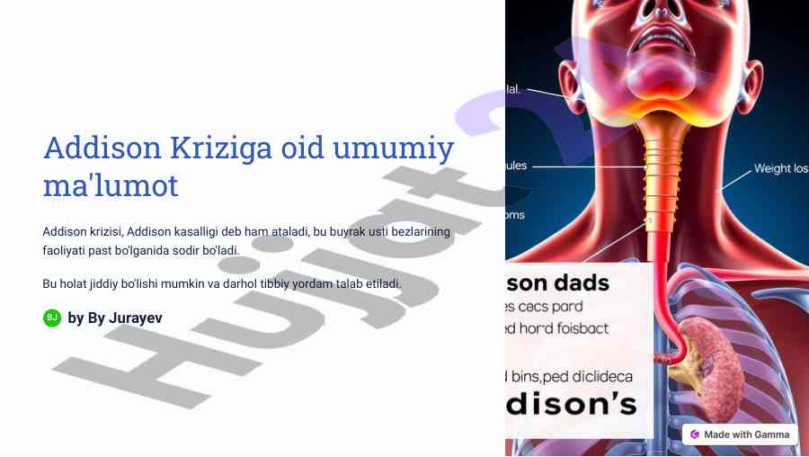 Addison kriziga oid umumiy ma'lumotlar