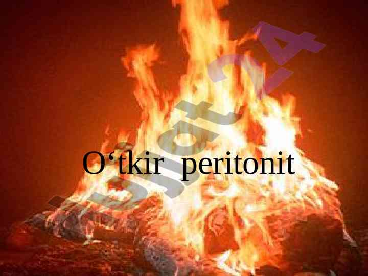 O‘tkir peritonit davolash usullari tahlili