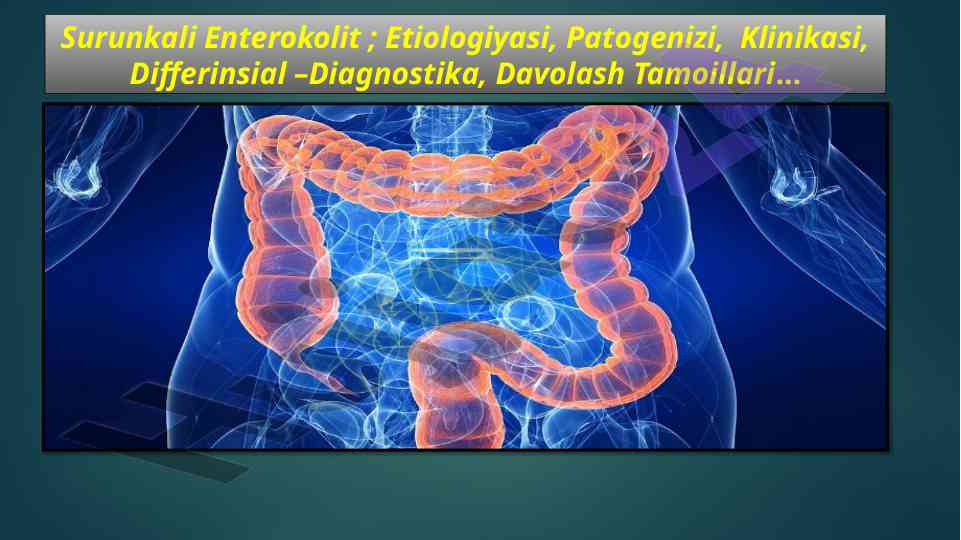Surunkali enterokolit: etiologiya, patogenez, klinikasi
