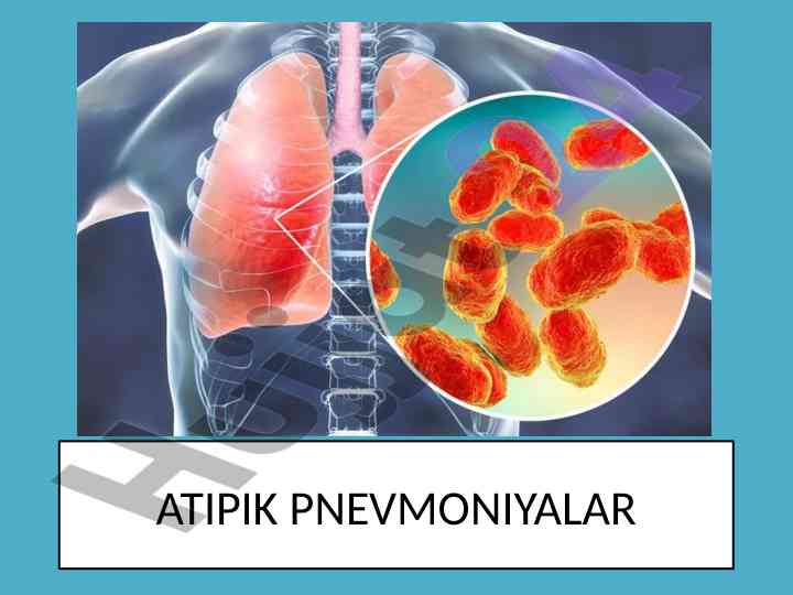 Atipik pnevmoniyalar va mikoplazmalarning xususiyatlari