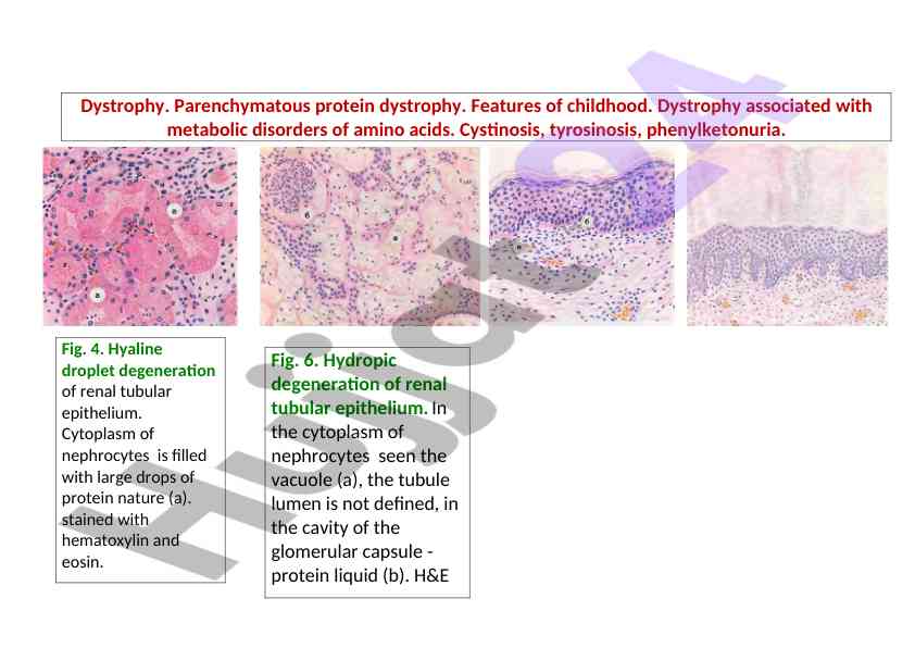 Dystrophy and metabolic disorders in childhood