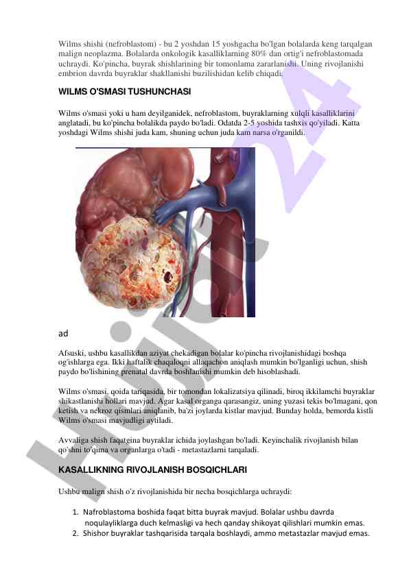 Wilms shishi: bolalar onkologiyasida nefroblastoma