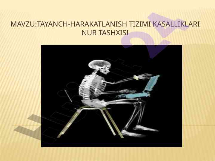 Tayanch-harakat tizimi kasalliklari tahlili