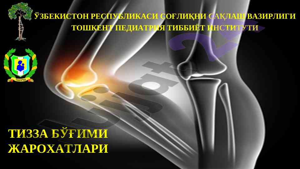 Тизза бўғими жарохатлари таҳлили