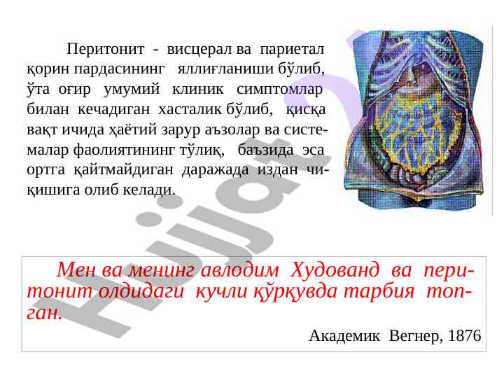 Перитонит: классификация ва белгилар бойича