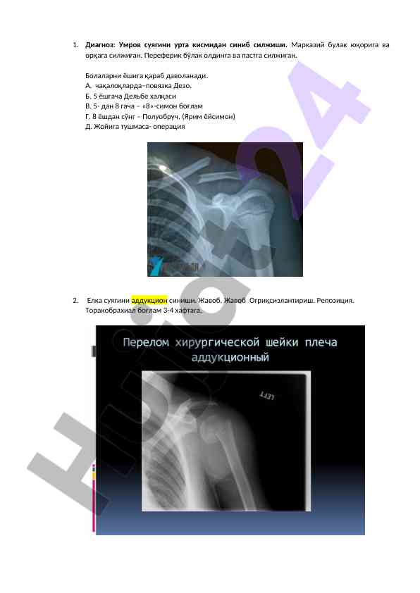 Umrov suyaqini sinişi va siljishi diagnostiği