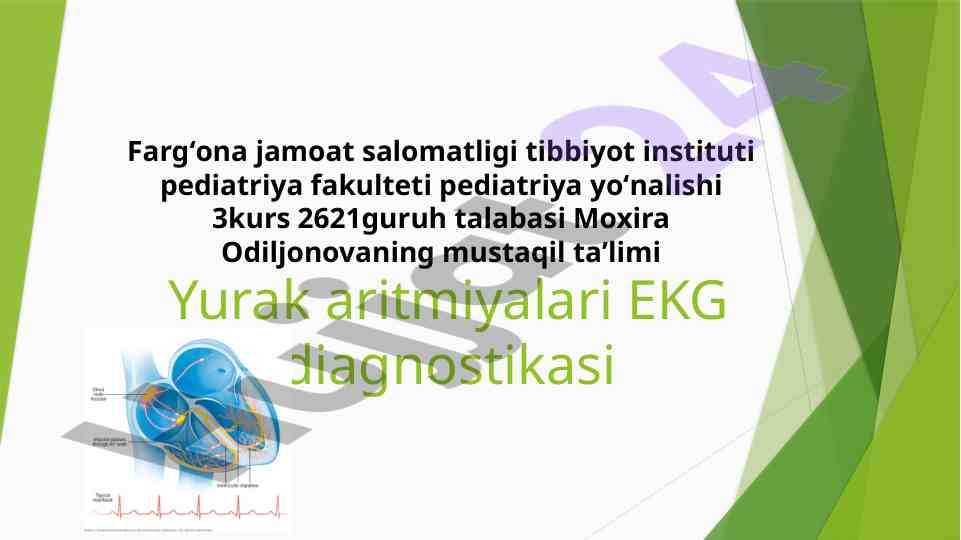 Yurak aritmiyalari ekg diagnostikasi asoslari