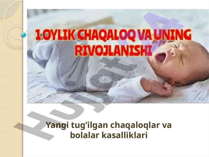Yangi tug'ilgan chaqaloqlar va kasalliklari