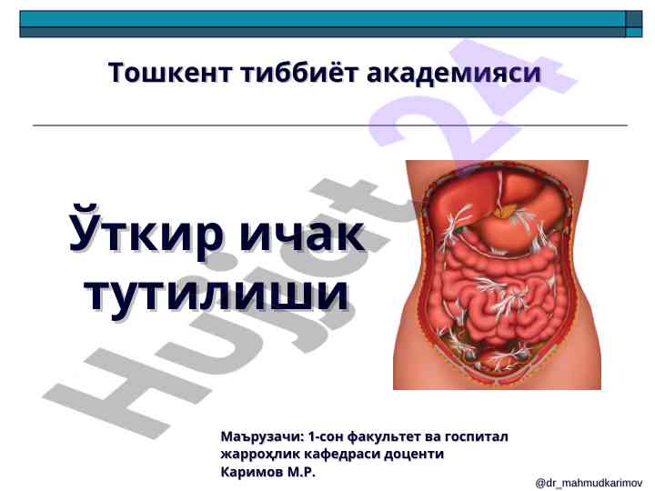 Ўткир ичак тutilishi тадқиқотлари ва тарихий маълумотлар