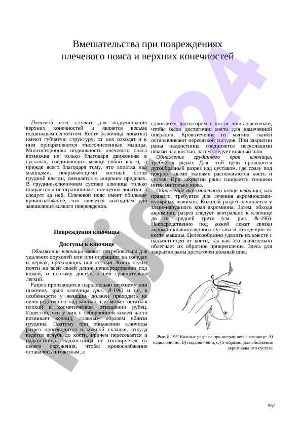 Vmeşatelstva pri povrejdjeniyakh plechevogo poyasa