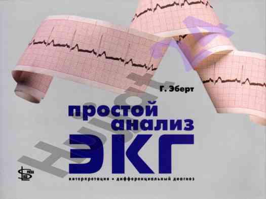 Простой анализ экг интерпретация дифференциальный диагноз