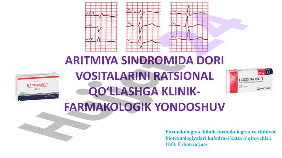 Aritmiya sindromida dori vositalarini ratsional qo‘llash