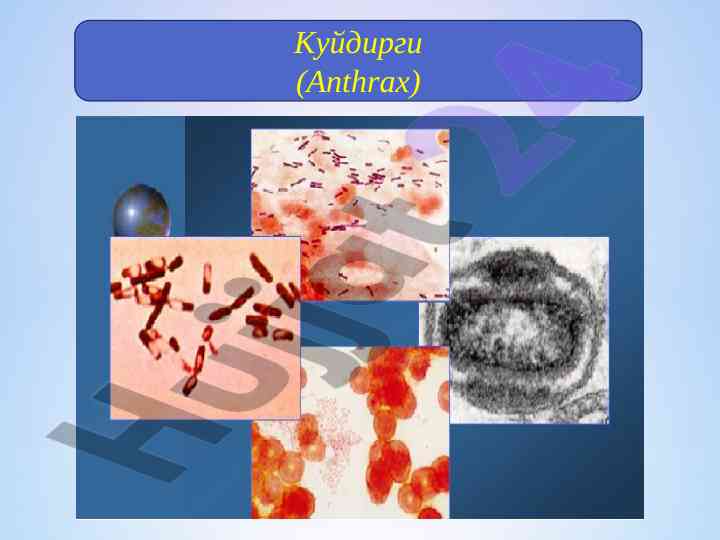 Куйдирги энтракс касаллиги тушунча