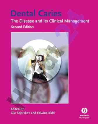 Dental caries clinical management insights