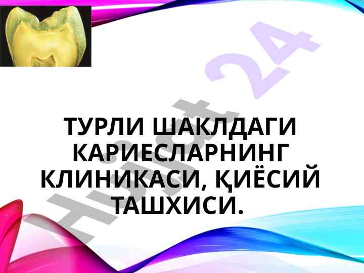 Тиш кариесини ташхислаш методи бўйича тадқиқотлар