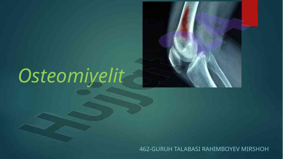 Osteomiyelit: suyak ko'migi yallig'lanishi sabablari