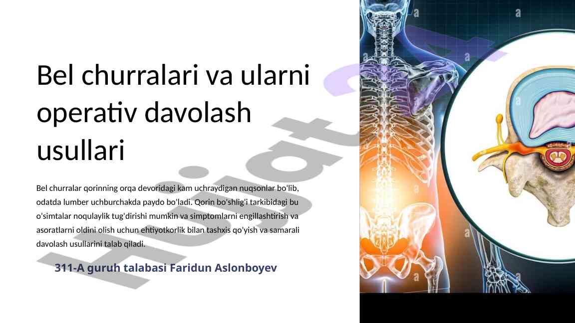 Bel churralari va ularni operativ davolash usullari