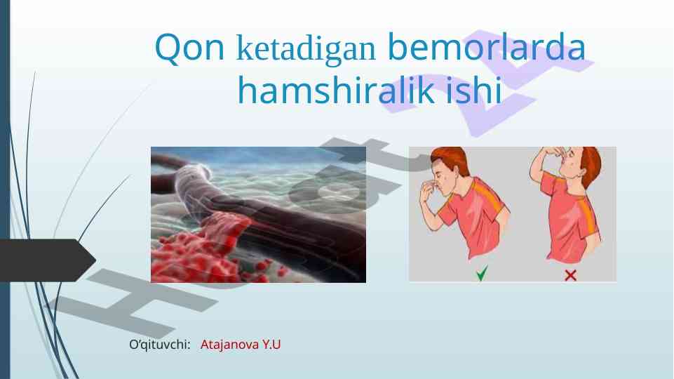 Qon ketish tushunchasi va hamshiralik ishlari