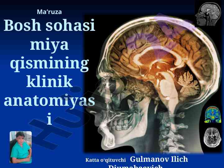 Klinik anatomiyasi bosh sohasi miya qismi