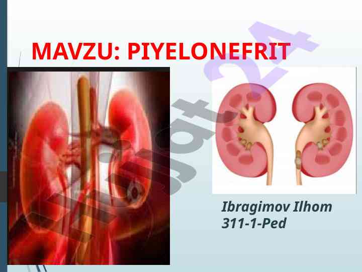 Piyelonefrit kasalligi va uning klinikasi