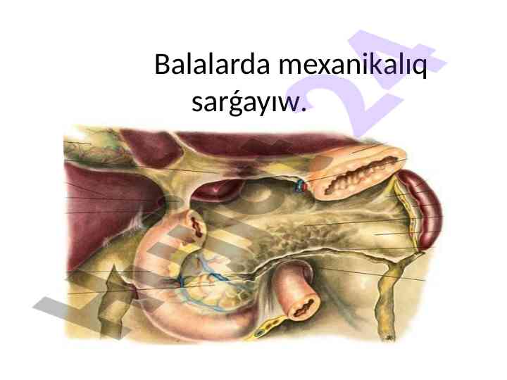 Mexanikalıq sarǵayıw: belgileri va diagnostikasi