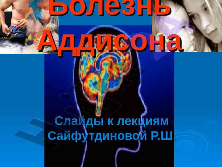 Болезнь аддисона анатомо-физиологические особенности