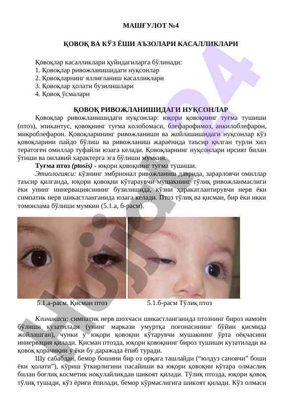 Ковоқ ва кўз ёши аъзолари касалликлари таълили