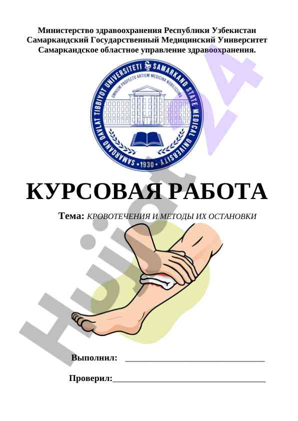 Кровотечения и методы их остановки
