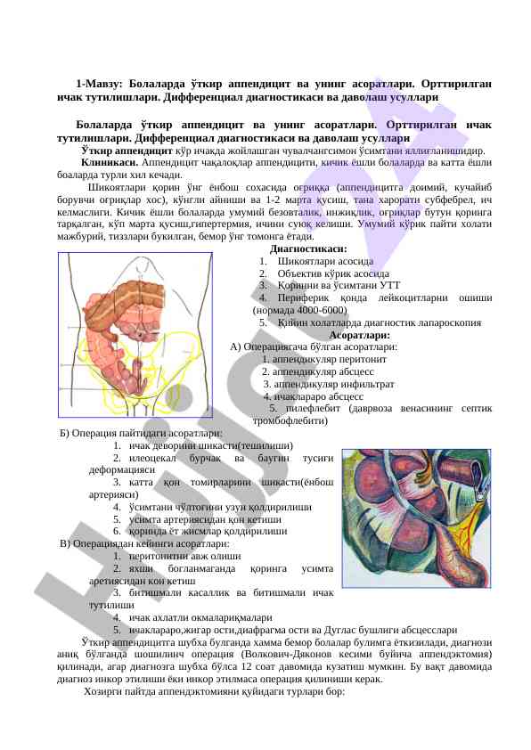 Bolalarda o'tkir appenditsit diagnostikasi va davolash