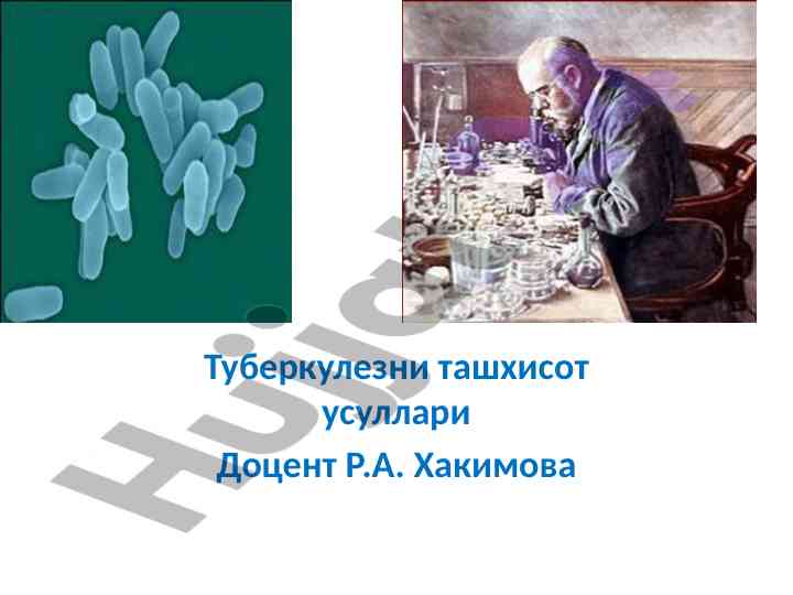 Туберкулезни ташхисот усуллари танлови