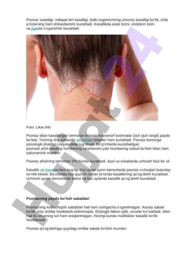 Psoriaz xastaligi va uning tizimga ta'siri