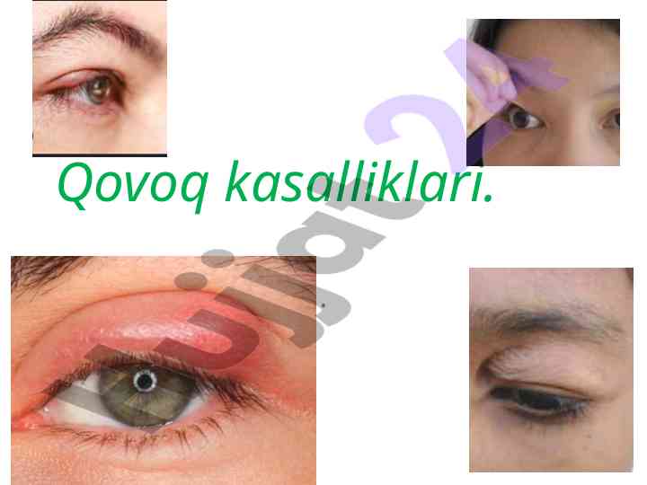 Qovoq kasalliklari va patalogiyasi