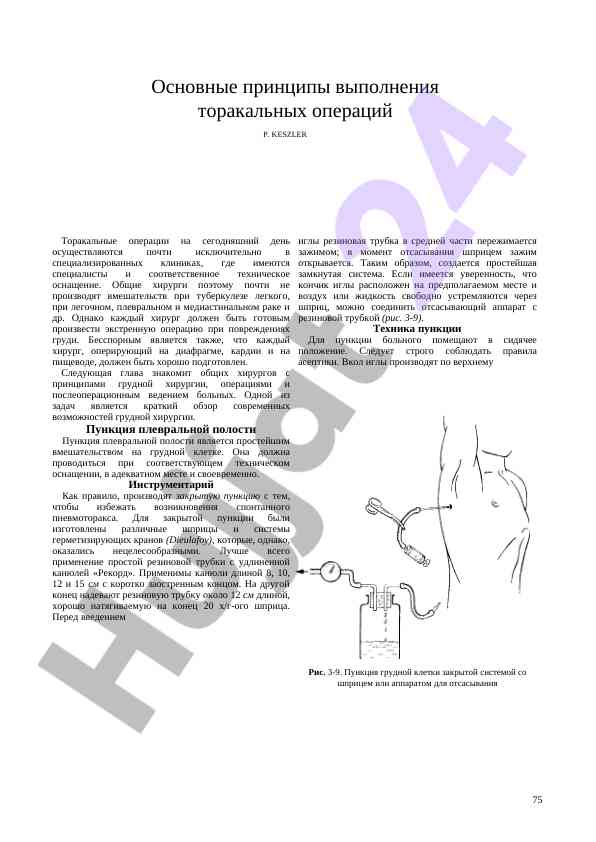 Osnovnye printsipy vypolneniya torakal'nykh operatsiy