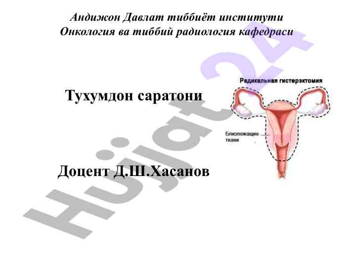 Тухумдон саратони: диагностика ва даволаш вариантлари