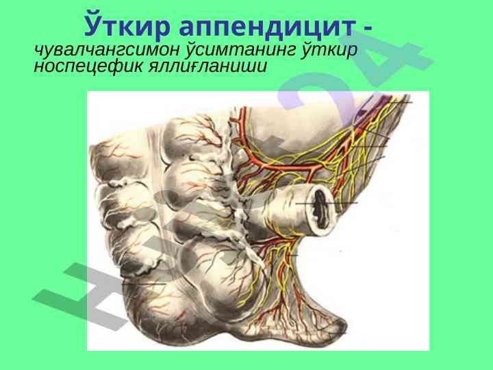 Ўткир аппендицит ҳуқуқий ташкилотлар да энг кўп носпециалик