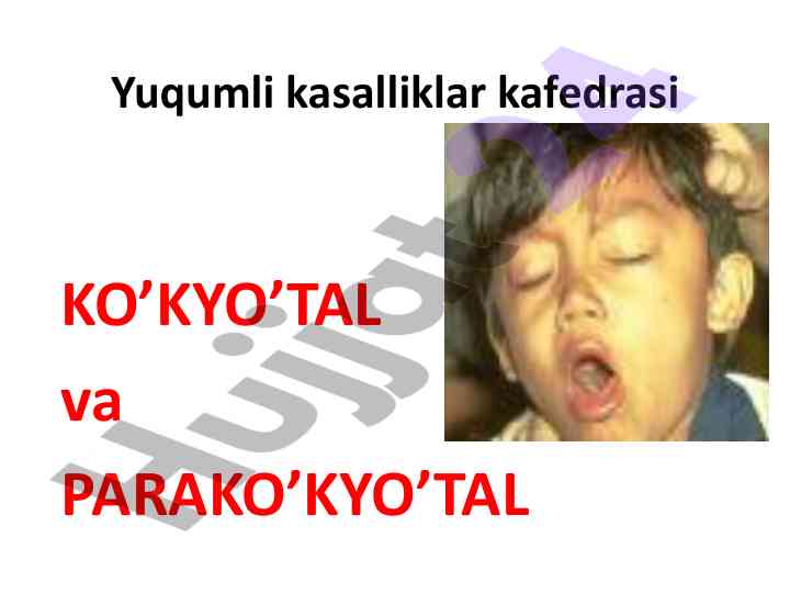 Ko’kyo’tal va parako’kyo’tal kasalliklari haqida ma’lumotlar