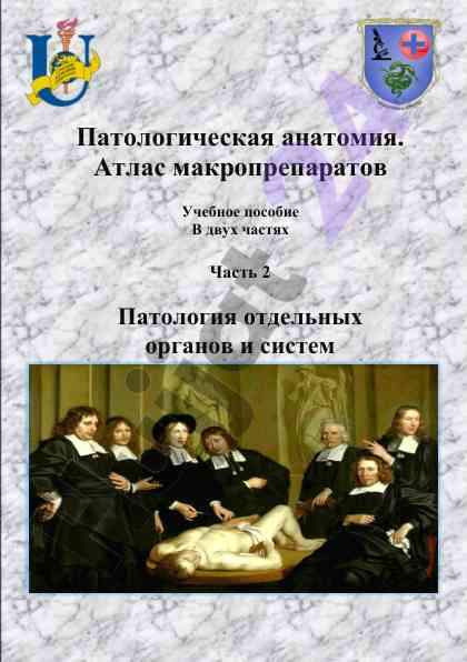 Патологическая анатомия атлас макропрепаратов часть 2