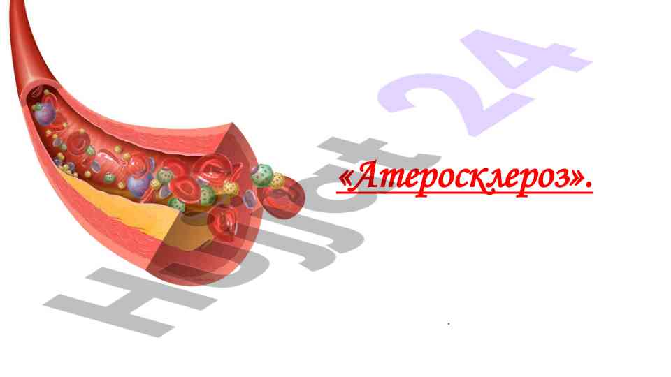 Ateroskleroz: xronik davolash va epidemiologiya