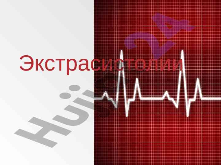 Экстрасистолии: классификация и этиология