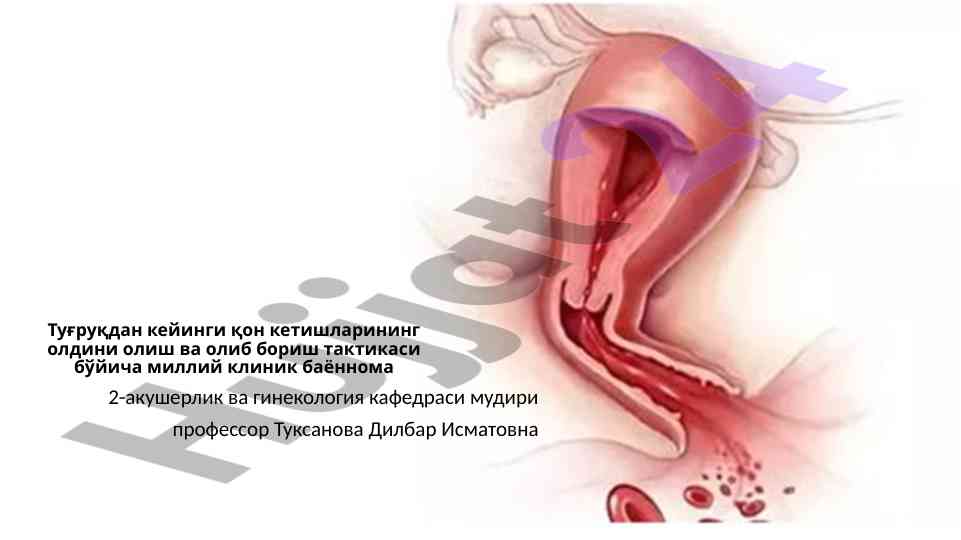 Туғруқдан кейинги қон кетишларининг олдини олиш тактикаси