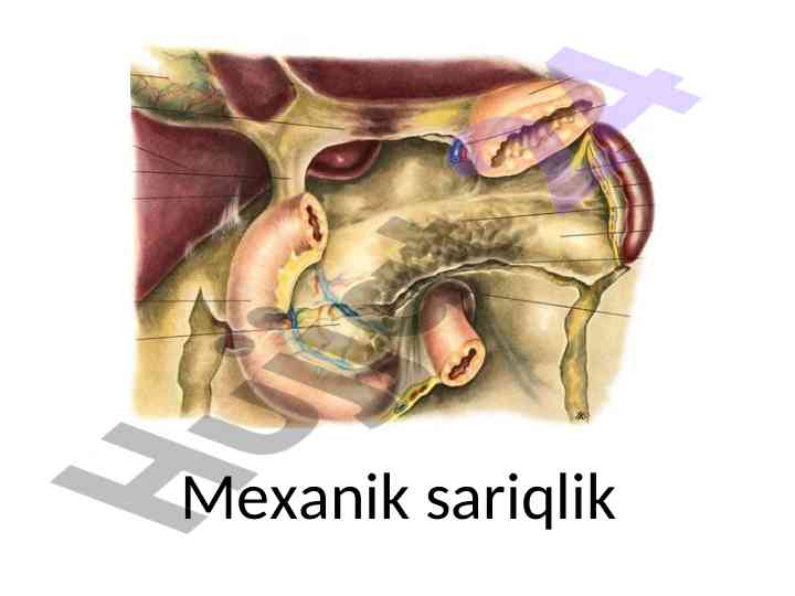 Mexanik sariqlik va parazitar invaziyalar tahlili