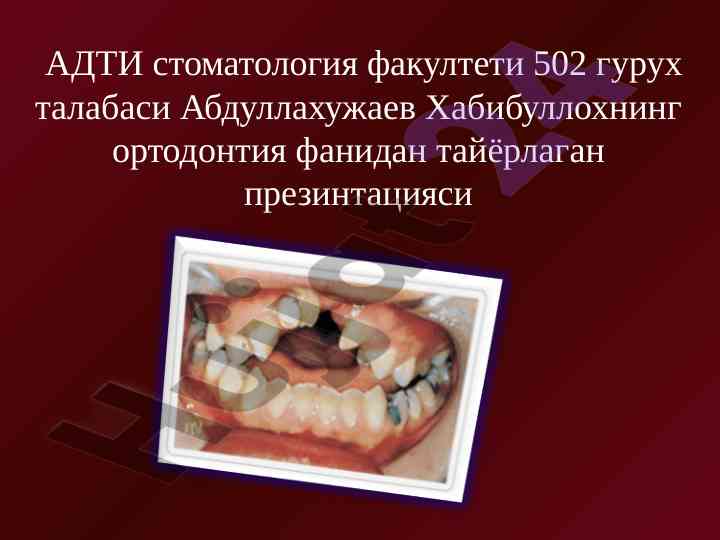 Ortodontiya fanidan taqdimot