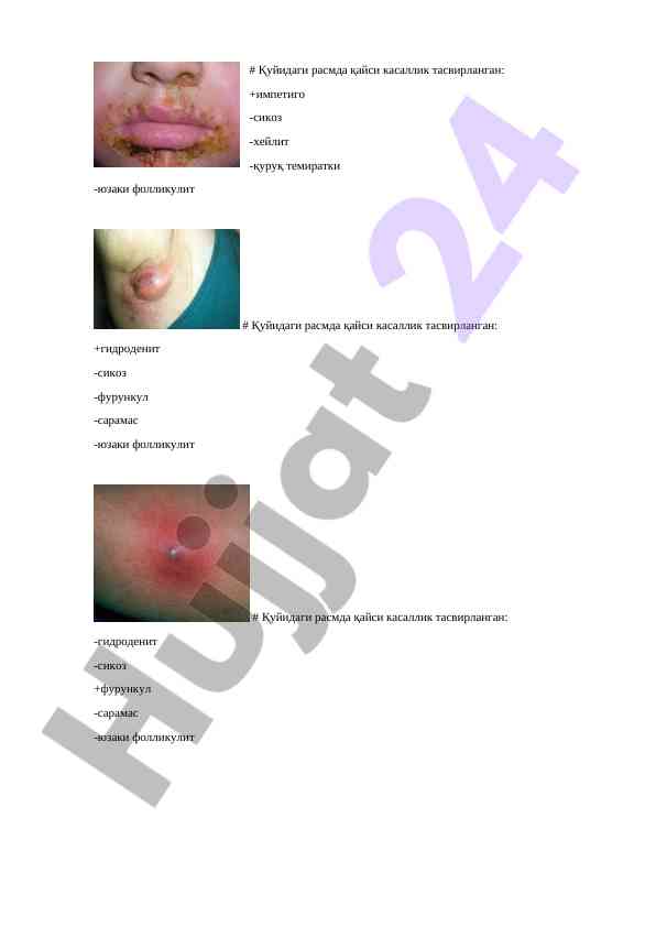 Skin conditions and their descriptions in medical images