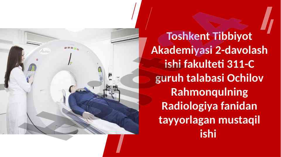 Multispiral kompyuter tomografiya tahlili