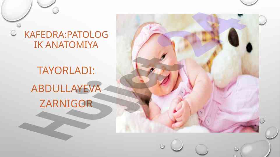 To'satdan o'lim sindromi va uning sabablari